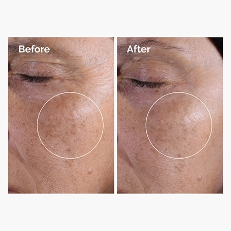 The Ordinary - Glycolic Acid 7% Exfoliating Toner - Tonik Peelingujący z 7% Kwasem Glikolowym - 100ml