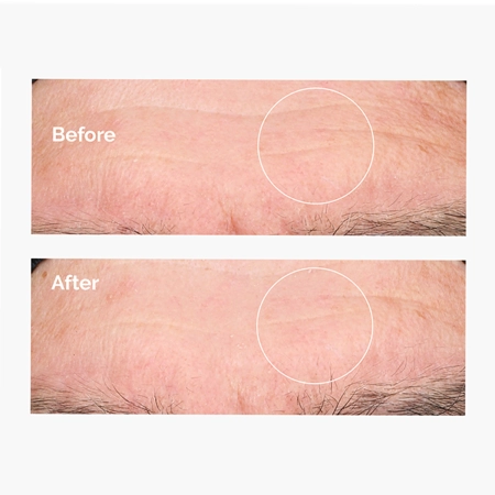 The Ordinary - Hyaluronic Acid 2% + B5 - Serum Nawilżające z Kwasem Hialuronowym 2% i Witaminą B5 - 60ml