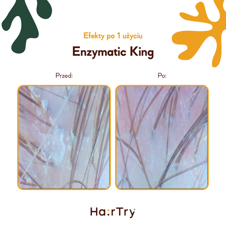 HairTry - Enzymatic King - Trychologiczny Peeling Enzymatyczny z Ficyną - 100ml - OUTLET