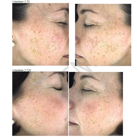 Nerds. - Hyperpigmentation Serum - 2% Alpha Arbutin + 1% Kojic Acid - Serum na Przebarwienia - 2% Alfa-Arbutyna + 1% Kwas Kojowy - 30ml